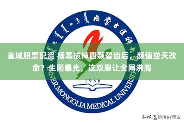 宣城股票配资 杨幂拔掉四颗智齿后，颜值逆天改命？生图曝光，这双腿让全网沸腾